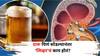 Health: 'अचानक दारू पिणं बंद केलं तर लिव्हरचं काय होतं?' 'असे' होतात बदल की जाणून आश्चर्यचकित व्हाल!