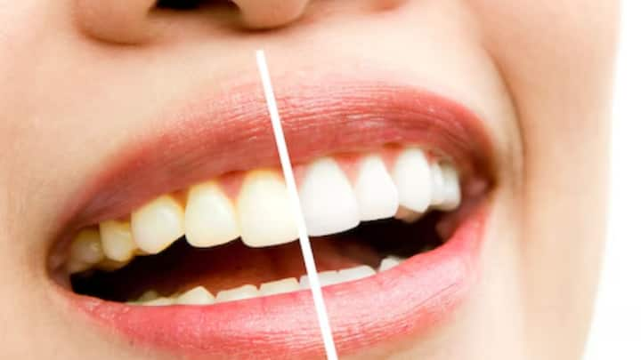 Oral Care Tips: ধূমপানে কী ক্ষতি হয় দাঁতের, যাঁদের হয়েছে, তাঁরা জানেন। ছবি: ফ্রিপিক।