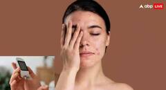 Diabetes ਦਾ ਸੰਕੇਤ ਹੋ ਸਕਦੀਆਂ Skin ਦੀਆਂ ਆਹ ਸਮੱਸਿਆਵਾਂ, ਨਜ਼ਰਅੰਦਾਜ਼ ਕਰਨਾ ਪੈ ਸਕਦਾ ਮਹਿੰਗਾ