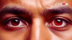 पूरी दुनिया में बढ़ा ब्लीडिंग आई वायरस का खतरा, जानें इसके लक्षण और बचाव