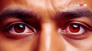 पूरी दुनिया में बढ़ा ब्लीडिंग आई वायरस का खतरा, जानें इसके लक्षण और बचने का तरीका