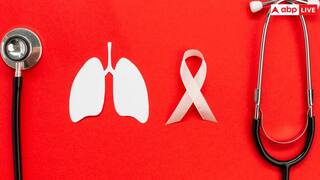 Lungs Cancer: किन कारणों से हो जाता है फेफड़े का कैंसर? जानें इसके इलाज का तरीका
