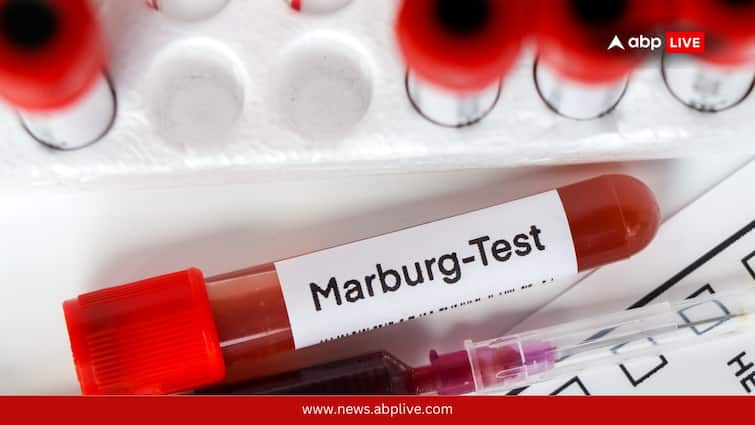 What Is The 'Bleeding Eye' Virus That Has Sparked Global Fear? All About The Deadly Marburg Disease