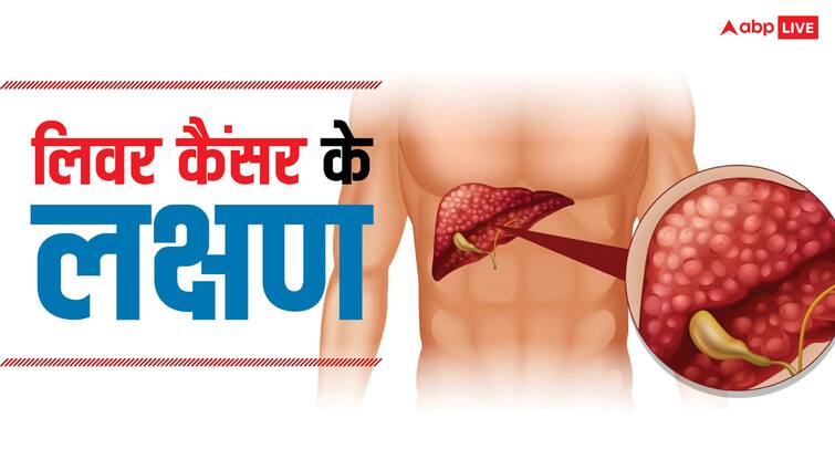 लिवर कैंसर के लक्षण, लक्षण, कारण और उपचार हिंदी में पूरा लेख पढ़ें लिवर कैंसर के लक्षण, लक्षण, कारण और उपचार हिंदी में पूरा लेख पढ़ें