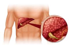 Health: શરીરમાં દરરોજ આ 5 લક્ષણો દેખાય તો લીવર કેન્સરની નિશાની, તમે તો ઇગ્નૉર નથી કરતાંને ?