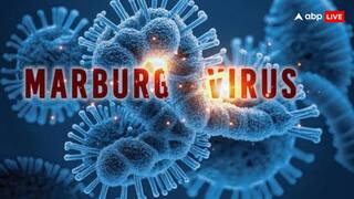 मारबर्ग वायरस से बचने के बाद न हो बेपरवाह, इन अंगों में सालों साल छिपा रहता है वायरस