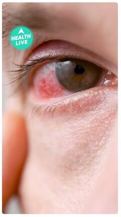 Did you know that there are some vitamins that are harmful for our eyes? | ABP Live