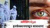 Health: ब्लीडिंग Eye व्हायरसपासून सावधान! डोळ्यातून वाहते रक्त? जगभरात पसरतोय धोका, ही लक्षणं तुम्हाला नाही ना?