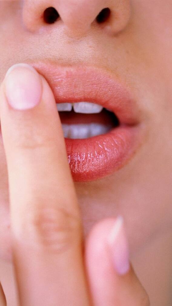 फाटलेल्या ओठांवर करा हे '5' घरगुती उपाय!