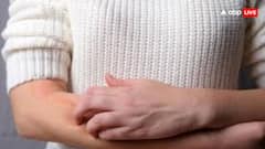 स्वेटर या जैकेट पहनते ही स्किन पर होने लगती है एलर्जी, कहीं आपको ये बीमारी नहीं?