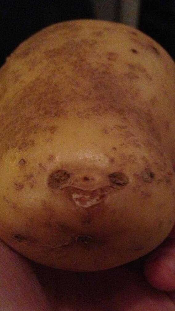 कच्चे बटाटे फ्रीजमध्ये 'का' ठेवू नये?