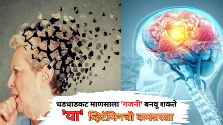 Vitamin B12 Deficiency: तुम्ही तुमच्या दररोजच्या लहानसहान गोष्टी विसरताय का? एखाद्या वेळी झालं तर ठिक आहे, पण तुमच्यासोबत हे सातत्यानं होत असेल, तर वेळीच सावध व्हा नाहीतर, तुम्ही हळूहळू सगळंच विसराल.