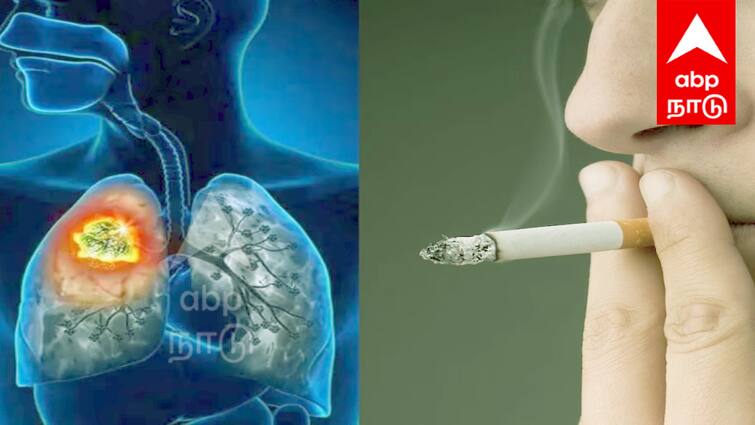 Anbumani Ramadoss says Lung cancer also affects non-smokers tnn புகைக்காதவர்களையும் தாக்கும் நுரையீரல் புற்றுநோய் ; பகீர் கிளப்பும் அன்புமணி