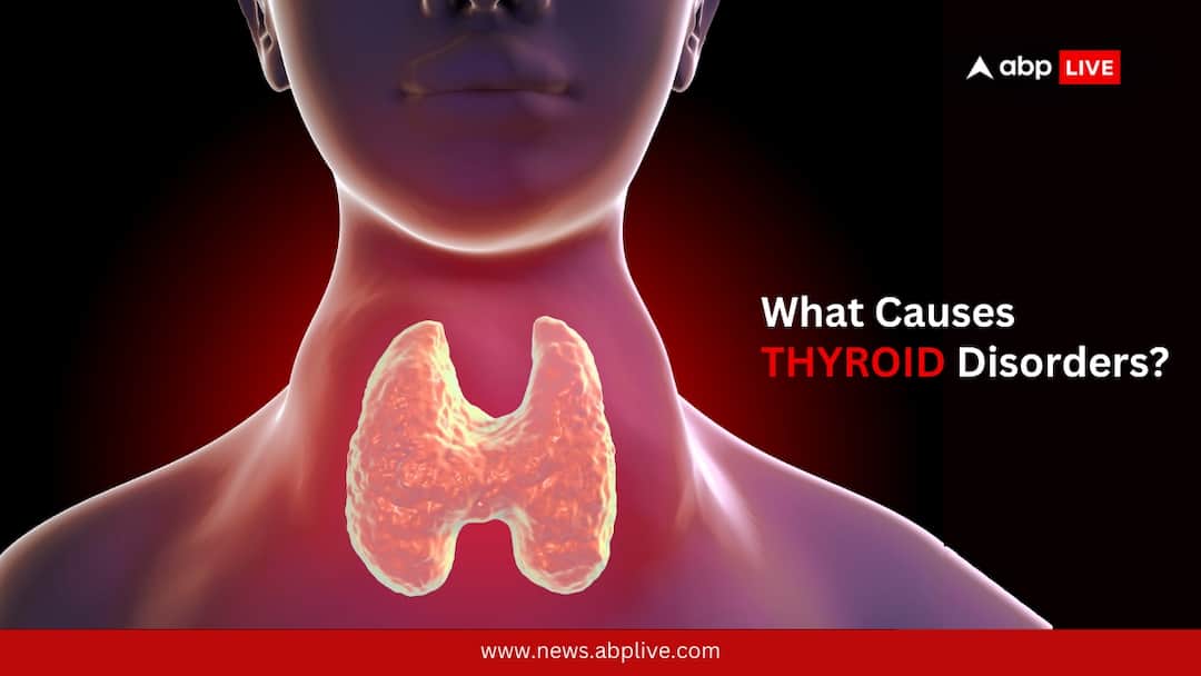 Thyroid Disorders Causes Symptoms screening Tests Importance Of Early Diagnosis What Causes Thyroid Disorders? Know Symptoms, Tests, And Importance Of Early Diagnosis