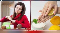 ਸਰਦੀਆਂ 'ਚ ਹੱਥਾਂ ਨੂੰ ਖੁਸ਼ਕੀ ਤੋਂ ਬਚਾਉਣ ਦੇ ਲਈ ਕਰੋ ਇਹ ਕੰਮ, ਅਪਣਾਓ ਇਹ ਘਰੇਲੂ ਨੁਸਖੇ