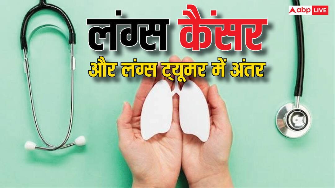 health tips what is difference between lung cancer and lung tumor Know symptoms लंग्स कैंसर और लंग्स ट्यूमर में क्या होता है अंतर? जान लीजिए दोनों के लक्षण