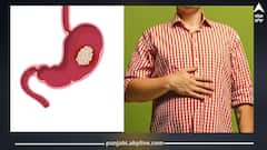 ਪੇਟ ਦੇ ਕੈਂਸਰ ਦੇ ਇਹ 3 ਲੱਛਣ ਸਿਰਫ ਸਵੇਰੇ ਹੀ ਦਿਖਾਈ ਦਿੰਦੇ...ਬਚਾਅ ਲਈ ਅਪਣਾਓ ਇਹ ਤਰੀਕੇ