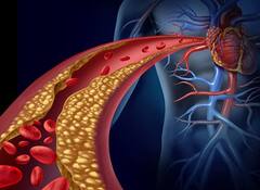 શિયાળાની ઠંડીમાં વધી જાય છે હાર્ટ એટેકનો ખતરો, સવારે ઉઠતા જ કરી લો આ કામ,રહેશો ફાયદામાં 