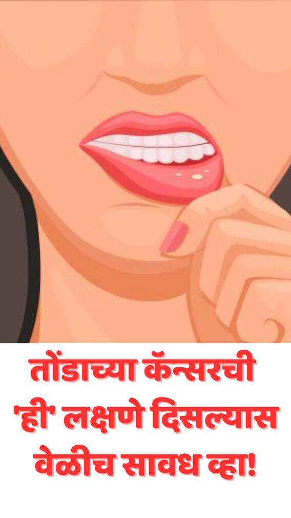 तोंडाच्या कॅन्सरची 'ही' लक्षणे दिसल्यास वेळीच सावध व्हा!