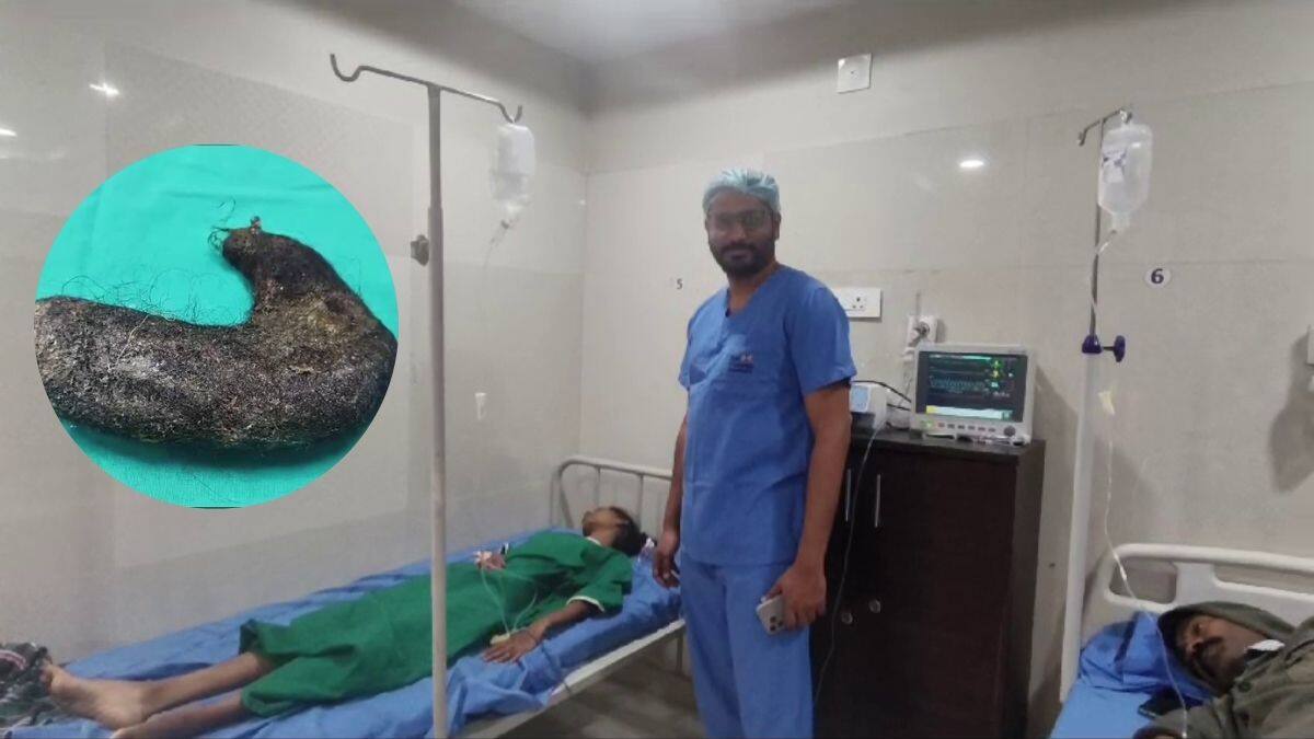 Viral News: బాలికకు తీవ్రమైన కడుపునొప్పి, టెస్టులు చేసిన డాక్టర్లు షాక్‌