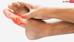 How To Control Uric Acid: યુરિક એસિડને કંટ્રોલ કરવા માંગો છો, આજથી ખાવાનું શરુ કરી દો આ વસ્તુ