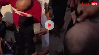 20 रुपये में बाल उगाने का दावा करने वाले की हुई चांदी, गंजे लोगों की जुट गई भीड़- वीडियो वायरल