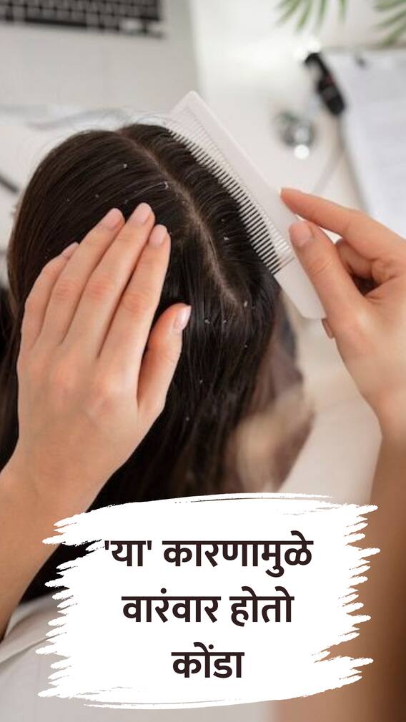 'या' कारणामुळे वारंवार होतो कोंडा!