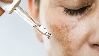 Beauty Tips: ਚਿਹਰੇ ਦੇ ਦਾਗ਼-ਧੱਬਿਆਂ ਨੂੰ ਗ਼ਾਇਬ ਕਰ ਦੇਵੇਗਾ ਆਲੂ ਦਾ ਰਸ, ਬੱਸ ਜਾਣ ਲਓ ਇਸ ਨੂੰ ਲਾਉਣ ਦਾ ਸਹੀ ਤਰੀਕਾ