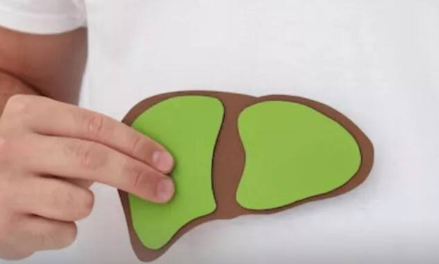 જો તમે મેદસ્વી છો, તો વજન ઓછું કરવું ખૂબ જ જરૂરી છે. વજન ઘટાડીને તમે ફેટી લીવરનું જોખમ ઘટાડી શકો છો. તમારા આહારમાં સ્વસ્થ ખોરાકનો સમાવેશ કરવો મહત્વપૂર્ણ છે. ઉપરાંત, જંક અને પ્રોસેસ્ડ ફૂડ ખાવાનું ટાળો. દરરોજ ઓછામાં ઓછી 30 મિનિટ કસરત કરવાથી લીવરને સ્વસ્થ રાખવામાં મદદ મળે છે અને ફેટી લીવરનું જોખમ ઓછું થાય છે.