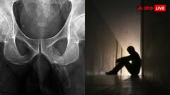 हड्डी बन गया शख्स का प्राइवेट पार्ट, डॉक्टर्स के उड़े होश, बीमारी जान हैरान रह जाएंगे आप