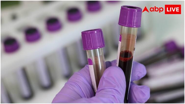 How blood groups are decided and how they named  कैसे तय होते हैं ब्लड ग्रुप, कैसे रखे जाते हैं इनके नाम?