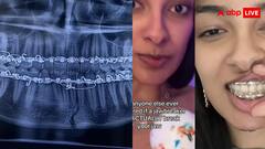 जॉब्रेकर कैंडी को चबाने के बाद महिला का टूट गया जबड़ा, हालत देख आ जाएगा तरस