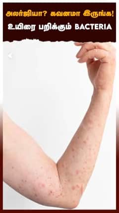 அலர்ஜியா? கவனமா இருங்க! உயிரை பறிக்கும் BACTERIA