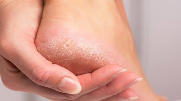 Winter Foot Care: বহু কিছুই ব্যবহার করেছেন, কিন্তু কিছু করেই কিছু হচ্ছে না। সেই ঘুরে ফিরে গোড়ালি-পায়ের অংশ ফাটা শুরু করেছে ? তাহলে দেখুন একনজরে..