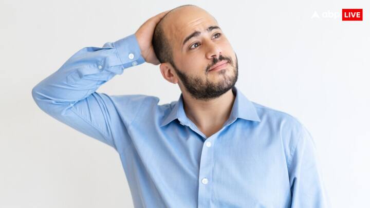 एक्सपर्ट के मुताबिक बाल झड़ने के कई कारण होते हैं. जिसमें केमिकल का ज्यादा इस्तेमाल करना, स्ट्रेस लेना, खान-पान और हार्मोंस बदलने के साथ कई अन्य कारण भी हैं.