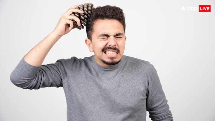 डायहाइड्रोटेस्टोस्टो एक तरह का हार्मोन होता है, जो बालों के विकास में मदद करता है. यही कारण है कि पीछे के बाल नहीं झड़ते हैं, सिर्फ आगे और बीच के बाल झड़ते हैं.