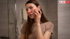 सर्दी के चलते खुरदुरी होने लगी है स्किन? रोजाना इस चीज से करें मालिश