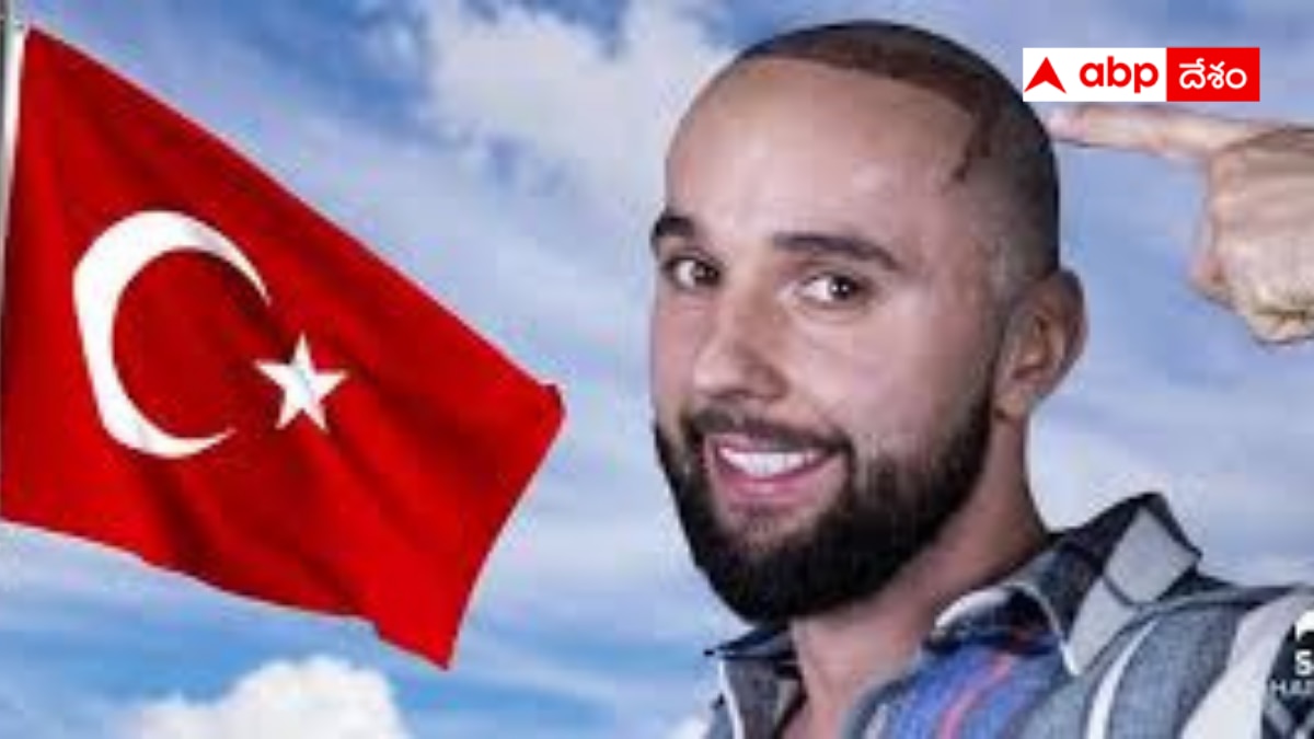 World hair Transplant Capital Turkey: గుండుపై జుట్టు మెలిపించుకోవాలా - చలో టర్కీ - ఇప్పుడు హెయిర్ ట్రాన్స్‌ప్లాంట్ క్యాపిటల్‌ అదే !