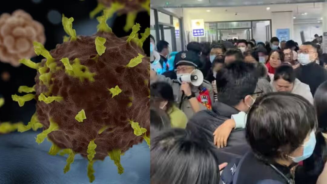 HMPV: திருந்தாத சீனா? அச்சுறுத்தும் HMPV வைரஸ், மிகவும் மோசமானதா? அறிகுறிகள், பாதிப்புகள் என்ன? hmpv outbreak in china all about human metapneumovirus its symptoms and precautions india on alert HMPV: திருந்தாத சீனா? அச்சுறுத்தும் HMPV வைரஸ், மிகவும் மோசமானதா? அறிகுறிகள், பாதிப்புகள் என்ன?