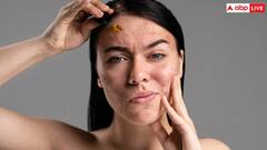 सर्दी के चलते खुरदुरी होने लगी है स्किन? रोजाना इस चीज से करें मालिश