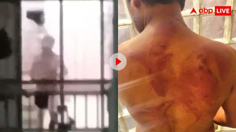 मुंब्रा में अपने ही फ्लैट में तौलिया लपेटकर घूमने पर युवक की लाठियों से पिटाई, वायरल हुआ वीडियो | अपने ही घर में अजीबोग़रीब घूमना तो लोगों ने फ़्रैंच फ़ीचर, उपभोक्ता बोले