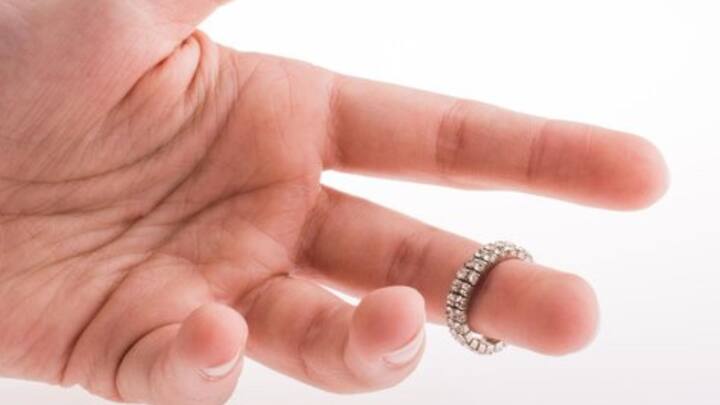 আঙুলে আংটি পরে থাকেন অনেকেই। সেভাবেই কেটে যায় বছরের পর বছর।