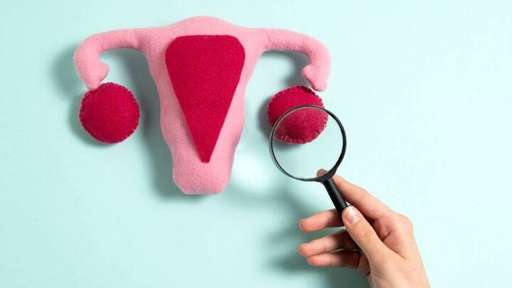 हालांकि, ज़्यादातर सर्वाइकल कैंसर के मामले HPV के कारण होते हैं, लेकिन आनुवंशिक कारक भी इसमें भूमिका निभा सकते हैं. अपने परिवार के इतिहास के बारे में जानकारी होना आपको और आपके डॉक्टर को सूचित स्क्रीनिंग निर्णय लेने में मदद कर सकता है.