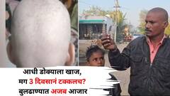 अजबच! आधी डोक्याला खाज, मग 3 दिवसानं थेट टक्कलच? बुलढाण्यात विचित्र आजाराने नागरिक हैराण, आरोग्य पथक पोहचलं गावात