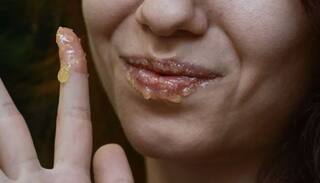 Dark Lips: ਬੁੱਲ੍ਹਾਂ ਦੇ ਕਾਲ੍ਹੇਪਨ ਨੂੰ ਦੂਰ ਕਰੇਗੀ ਹਲਦੀ, ਜਾਣੋ ਇਸ ਨੂੰ ਲਾਉਣ ਦਾ ਸਹੀ ਤਰੀਕਾ ?