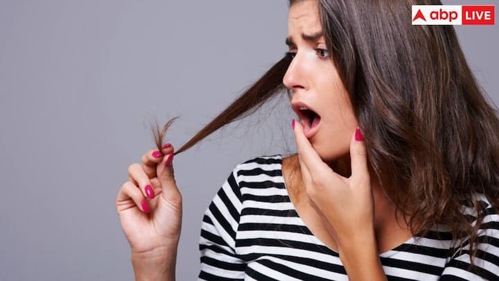 When there is a deficiency of any of these nutrients in the body or its quantity becomes very less, then the process of hair fall accelerates. That means your hair starts falling in quantity of 100 or more in a day.