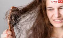 ਸਰੀਰ 'ਚ ਇਸ ਚੀਜ਼ ਦੀ ਕਮੀ ਕਾਰਨ ਤੇਜ਼ੀ ਨਾਲ ਝੜਨ ਲੱਗਦੇ ਨੇ ਵਾਲ, ਇੰਝ ਕਰੋ ਪਛਾਣ