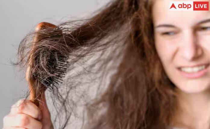 ਮਰਦਾਂ ਤੇ ਔਰਤਾਂ ਦੋਵਾਂ ਦੇ ਵਾਲ ਬਰਾਬਰ ਝੜਦੇ ਹਨ, ਪਰ ਗੰਜੇਪਨ ਦੀ ਸਮੱਸਿਆ ਔਰਤਾਂ ਦੇ ਮੁਕਾਬਲੇ ਮਰਦਾਂ ਵਿੱਚ ਵਧੇਰੇ ਪ੍ਰਚਲਿਤ ਹੈ। ਇਸ ਲੇਖ ਵਿੱਚ ਵਾਲ ਝੜਨ ਦੇ ਕਾਰਨਾਂ ਅਤੇ ਇਸਦੀ ਰੋਕਥਾਮ ਦੇ ਉਪਾਅ ਦੱਸੇ ਗਏ ਹਨ।