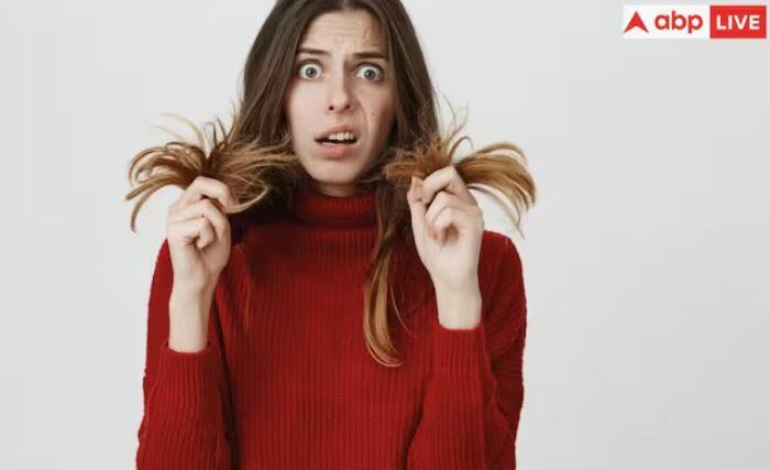 ਵਾਲਾਂ ਦਾ ਝੜਨਾ ਸਿਰਫ਼ ਵਾਲਾਂ ਦਾ ਝੜਨਾ ਨਹੀਂ ਹੈ। ਸਗੋਂ ਇੱਕ ਦਿਨ ਵਿੱਚ 70 ਤੋਂ ਵੱਧ ਵਾਲਾਂ ਦਾ ਡਿੱਗਣਾ ਵਾਲਾਂ ਦੇ ਝੜਨ ਦੀ ਸ਼੍ਰੇਣੀ ਵਿੱਚ ਆਉਂਦਾ ਹੈ। ਇਹ ਇਸ ਲਈ ਹੈ ਕਿਉਂਕਿ ਇੱਕ ਦਿਨ ਵਿੱਚ 70 ਵਾਲ ਝੜਨਾ ਆਮ ਗੱਲ ਹੈ।