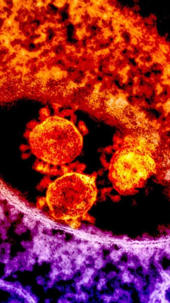 अस्थमा के मरीज HMPV से कैसे बचें?